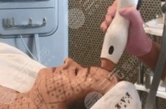 热玛吉去法令纹多少钱？肉眼可见的真实果~