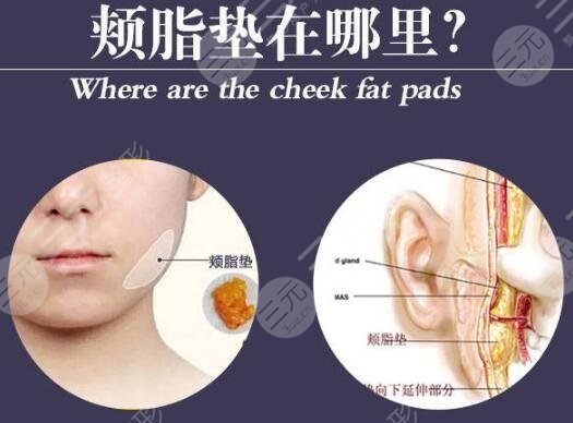 颊脂垫位置