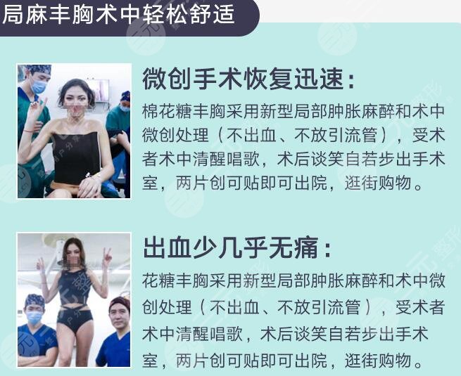 棉花糖丰胸手术优点