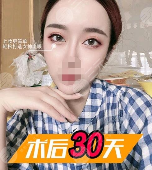 开眼角术后