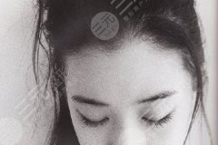 怎么样才能去掉眼袋？手术方法果看图~