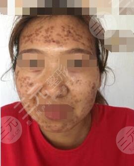 北京煤炭总医院医学美容整形中心