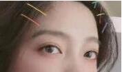 北京煤炭总医院医学美容整形中心