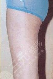 北京李医生医疗美容诊所