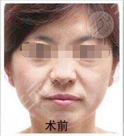北京明会红医疗美容诊所