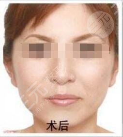 北京明会红医疗美容诊所