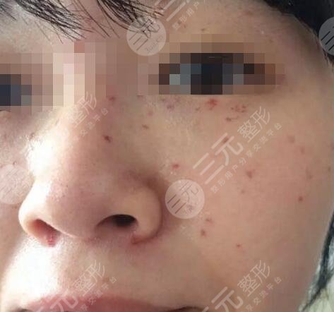 北京市海淀医院整形美容科