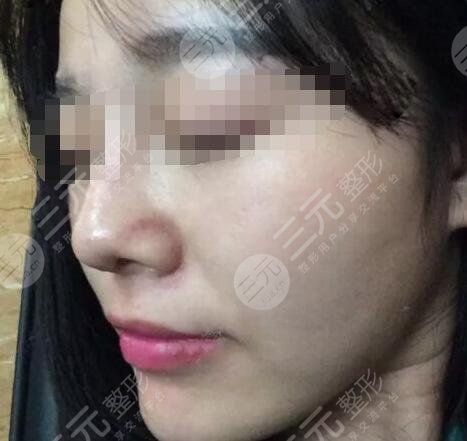 北京市海淀医院整形美容科