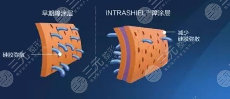 麦格假体价格多少