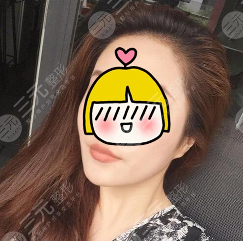 火凤凰微创溶脂果图