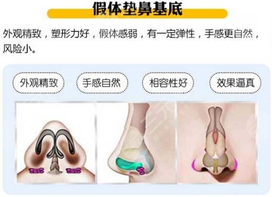 垫鼻基底手术价格
