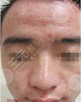 北京伊美尔幸福美容专科医院