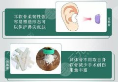 自体软骨隆鼻尖有什么要求?哪些人不宜做自体隆鼻尖? 自体软骨隆鼻尖有什么要求?哪些人不宜做自体隆鼻尖?