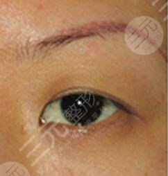 北京亚峰医疗美容诊所