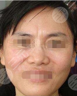 北京伊美尔美容健翔医院