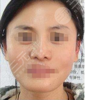 北京伊美尔美容健翔医院