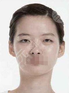 北京大学深圳医院美容整形科