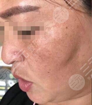 北京火箭军总医院激光整形美容中心