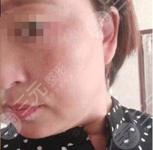 北京火箭军总医院激光整形美容中心