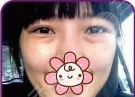 　北京伊美尚赴朝医疗美容诊所