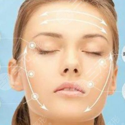 五v明星是埋线除皱?知识科普来喽！附真人案例！