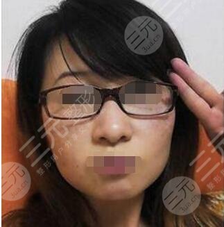 北京军区总医院激光整形中心