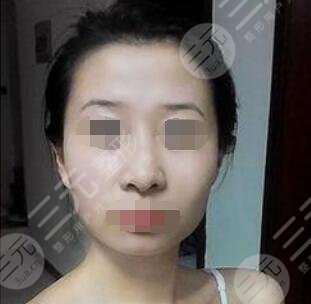 北京军区总医院激光整形中心