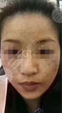 北京空军总医院激光整形美容中心