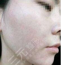 北京中关村医院激光整形美容中心
