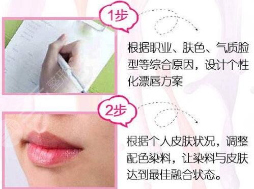 纹唇手术步骤