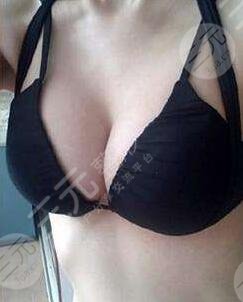 北京协会右安门医院整形美容科