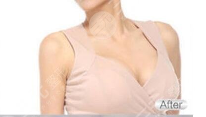 北京荣军医院激光美容中心