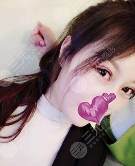 遵义医学院附属医院整形祛斑案例