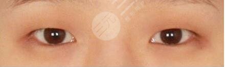 北京李沁奕华意医疗美容诊所