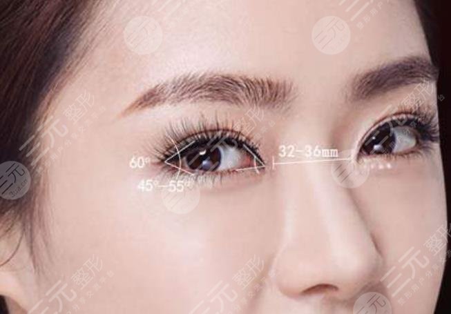 开眼角术后恢复需要多长时间