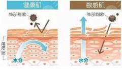 激光红血丝多少钱一次？多久恢复？有后遗症吗？