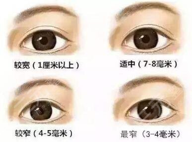 双眼皮宽度