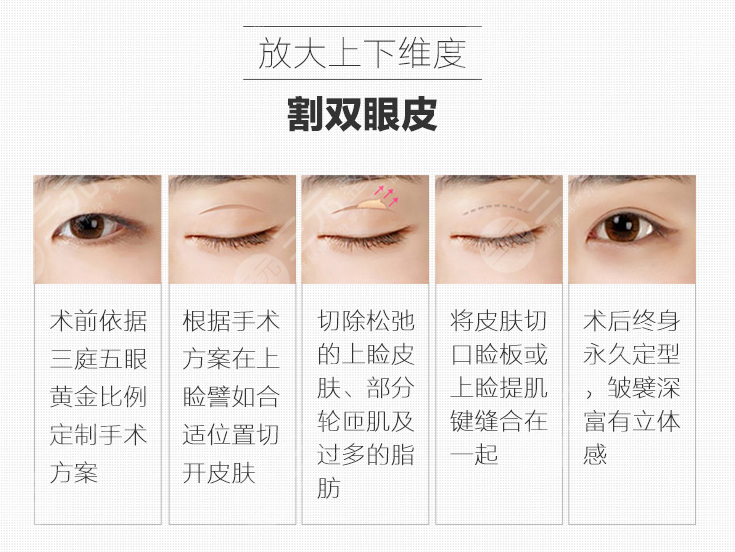 双眼皮全切大概多少钱