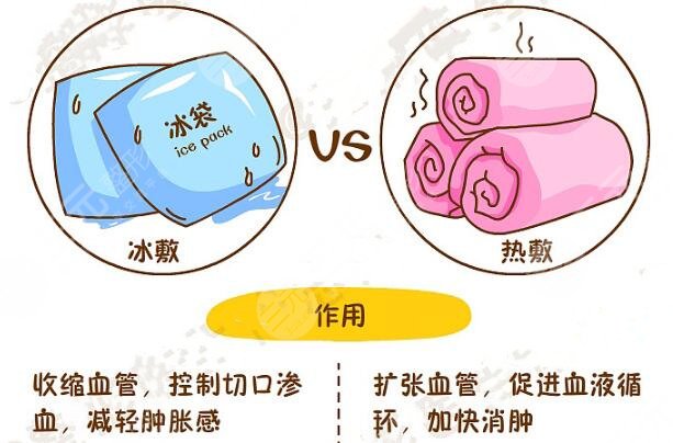 双眼皮全切术后如何快速消肿