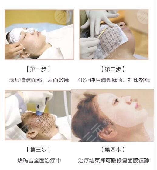 上海九院热玛吉价格2020