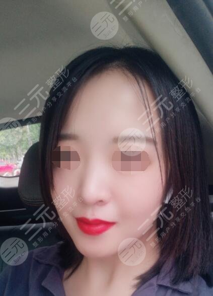 上海九院热玛吉术后