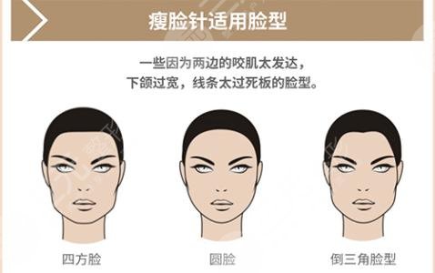 注射瘦脸适用脸型