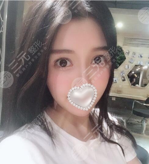 火凤凰溶脂有果吗