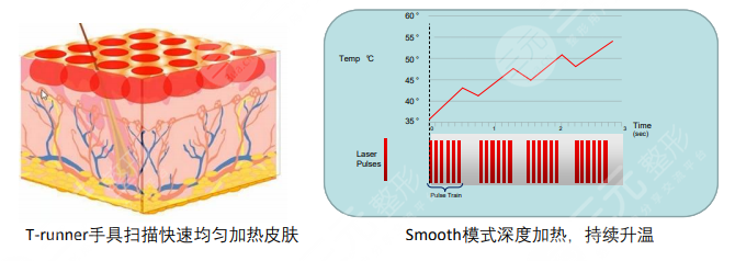 火凤凰溶脂原理