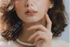 脸上长了黄褐斑怎么去除？形成原因及预防加重方法