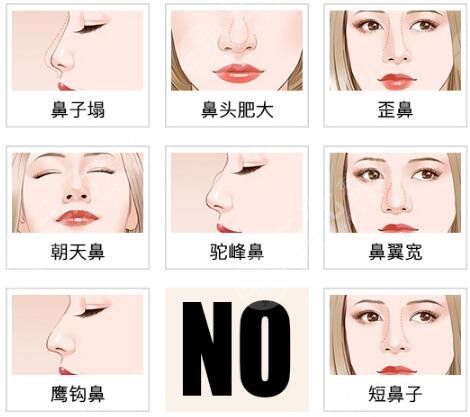 缩小鼻头多少钱