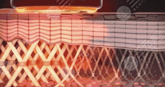 热玛吉的功作用