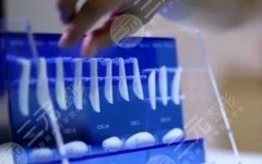 隆鼻术后忌口多长时间?多久能取出假体呢? 隆鼻术后忌口多长时间?多久能取出假体呢?