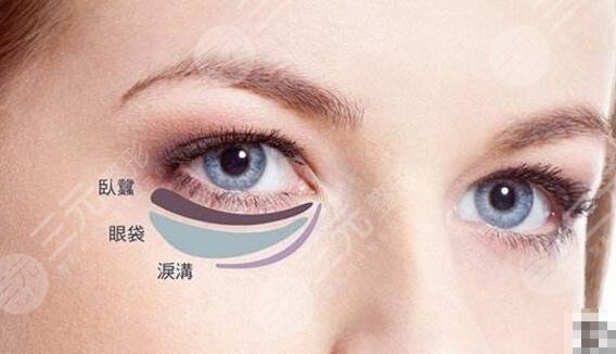 怎样去除下眼袋