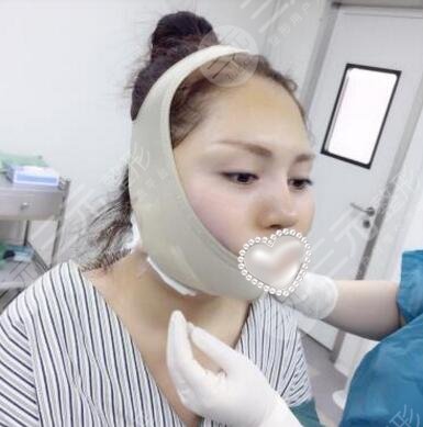 皮肤松弛下垂怎么办